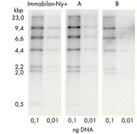 La cantidad de ADN cargada en el gel se disminuyó hasta 0,01 ng. Las bandas de 2,2 y 2,0 kbp en la línea 0,1 corresponden a 0,48 y 0,42 pg de ADN, respectivamente. Esto es equivalente aproximadamente a una sola copia de la secuencia de un gen en 10 µg de ADN genómico humano. La sensibilidad mejoró al duplicar la concentración de sonda. En las líneas de 0,01 ng, la membrana Immobilon-Ny+ fue ligeramente más sensible con un ruido de fondo más bajo que la membrana A de la competencia.